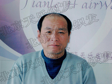 王小二秃正面
