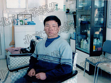 王小二补发正面